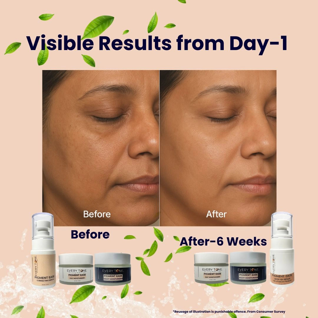 Pigment Ease Day Moisturizer