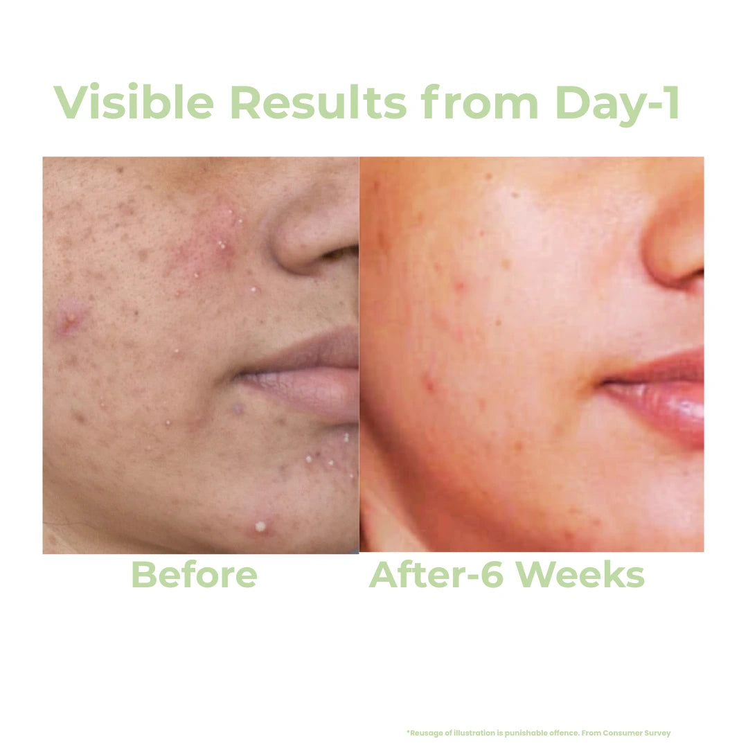 ClearMore Day Moisturizer