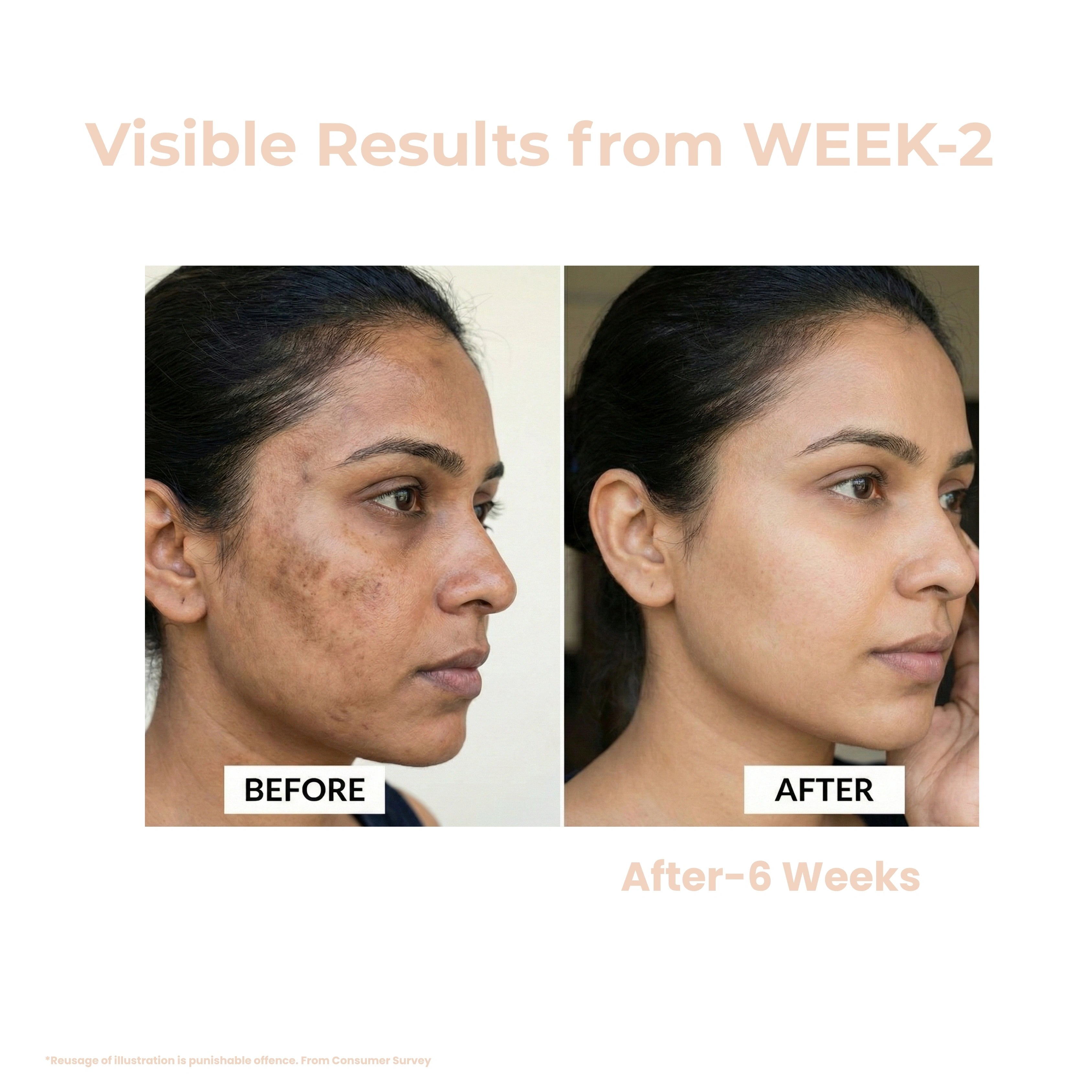 Pigment Ease Correcting Serum