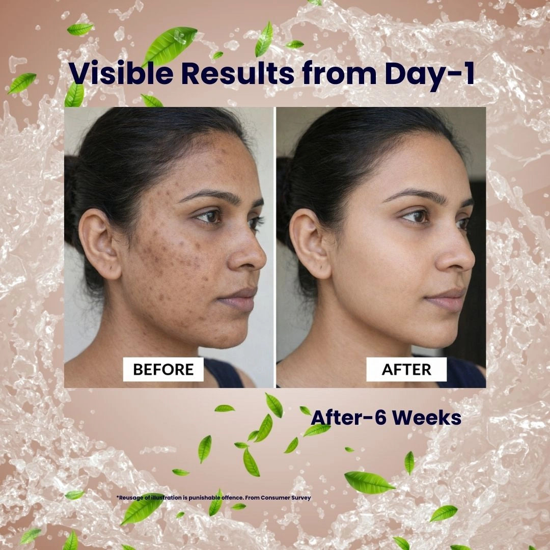 Pigment Ease Booster Serum