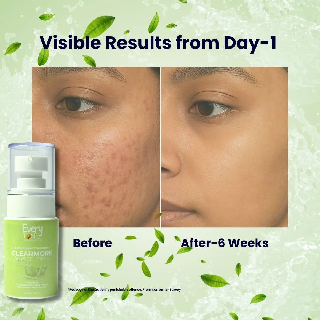 clearmore_before_and_after