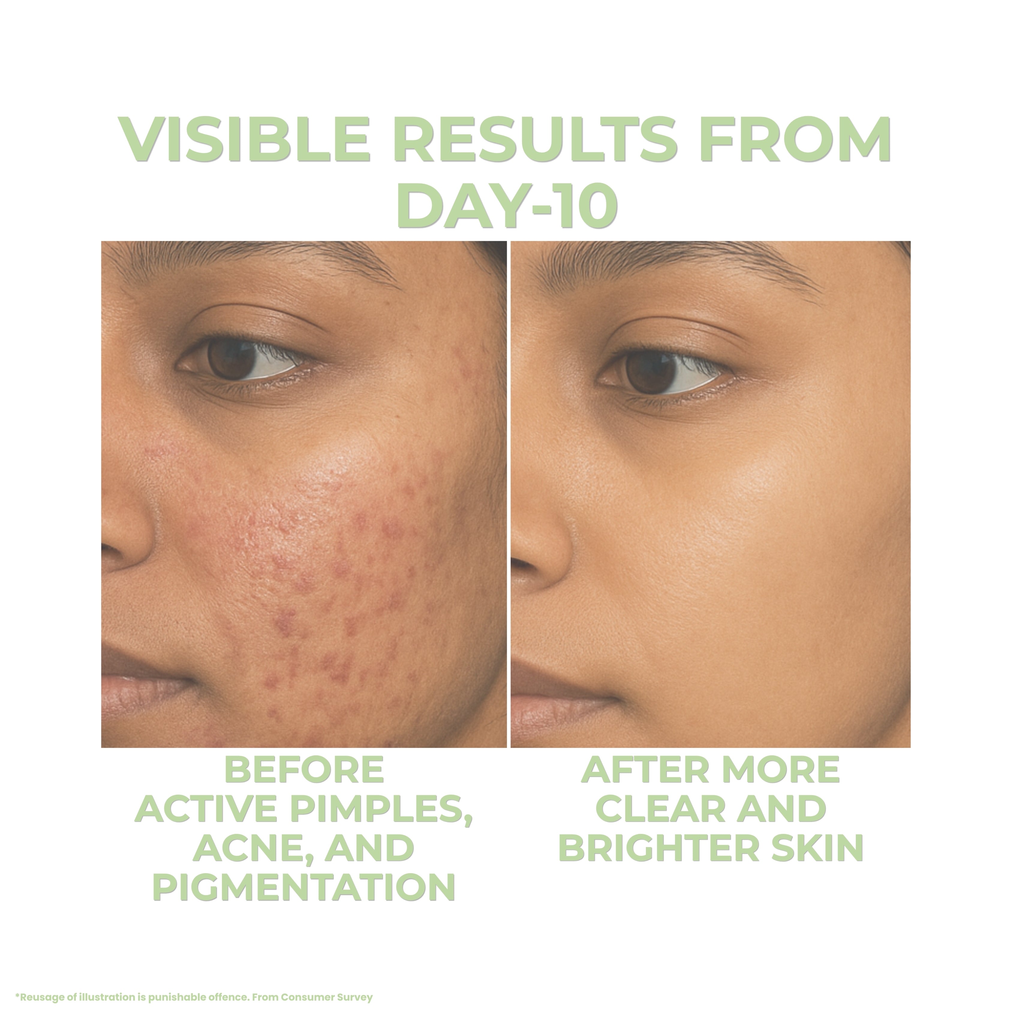 ClearMore Acne Gel Serum