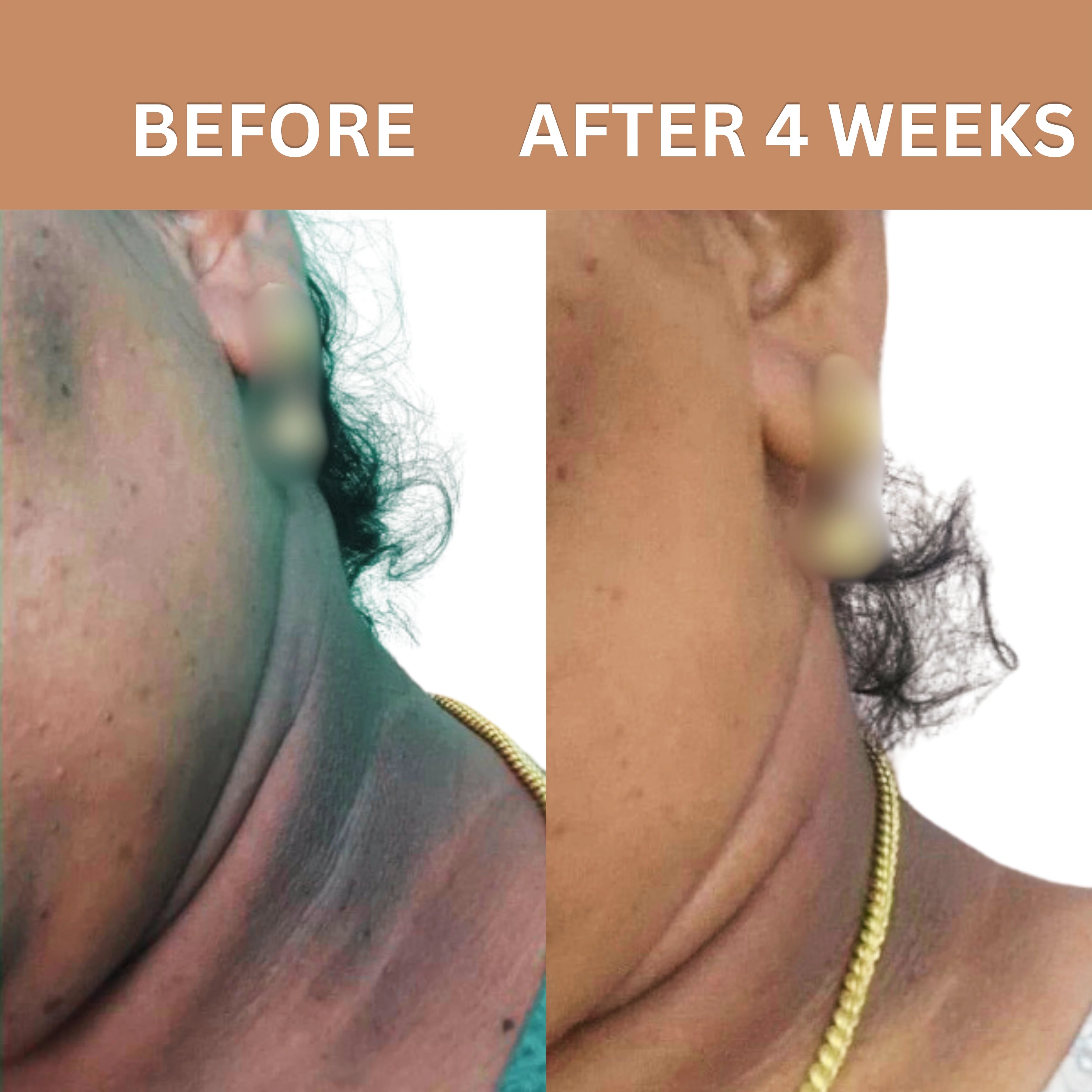 Pigment Ease Booster Serum